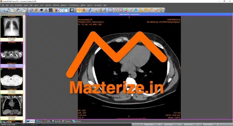 Sante DICOM Viewer Pro 14.2.7 for Windows Free Download Sante DICOM Viewer Pro Free Download