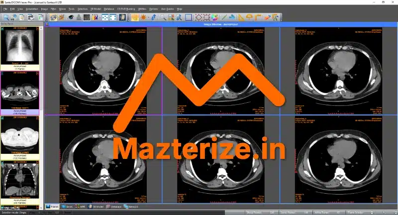 Sante DICOM Viewer Pro 14.2.7 for Windows Free Download Sante DICOM Viewer Pro Free Download